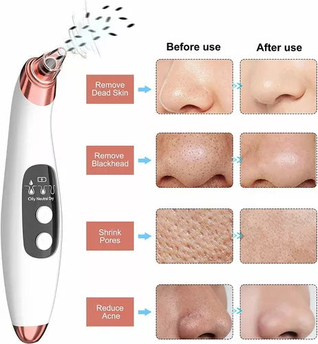 PURESKIN PRO